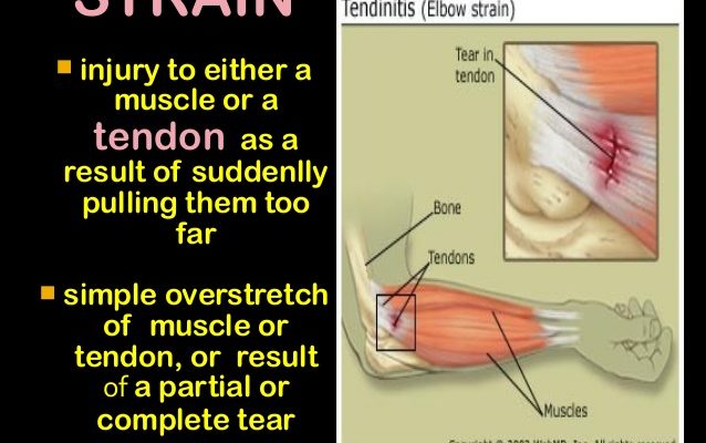 sprain-vs-strain-what-s-the-difference-zeusonmedicines-pvt-ltd